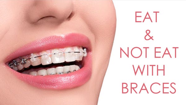 What can you eat and not eat with braces? | by Cape Town Orthodontist