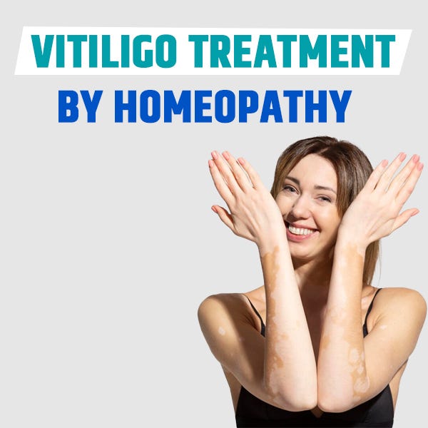 Homeopathic remedy for vitiligo treatment by Bharat Homeopathy Dec