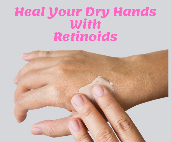 Tips for Treating Severely Cracked and Dry Hands by Alice Mary Skin