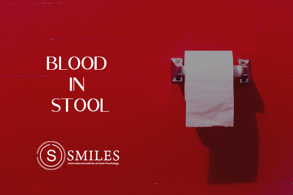 What are the causes of blood in stool?