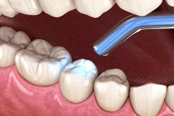 teeth cleaning in Nayapalli