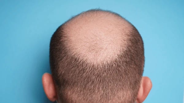 balding buzz cut