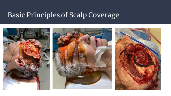 Dr. Joel Aronowitz — Basic Principles of Scalp Coverage