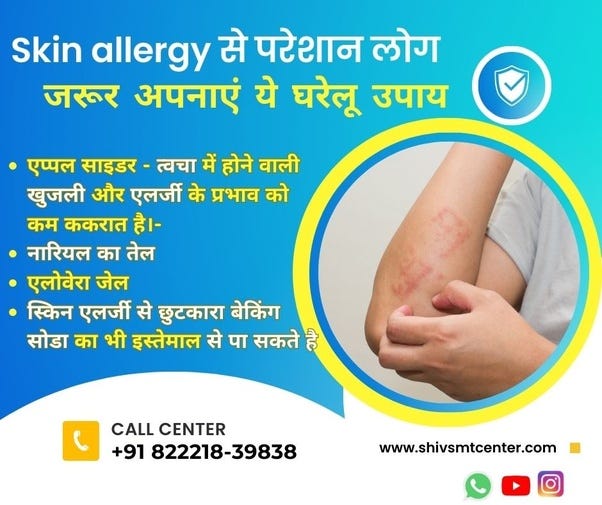 How to get rid From skin allergy at home ?? by Shiv Smt Center May