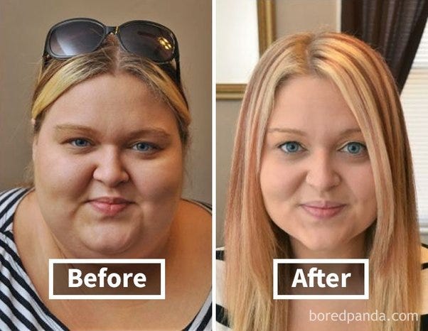 Weight Loss Before And After Face weight-loss-before-and-after-face