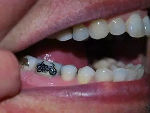 தங்கப்பல்லின் கதை (Story Of Golden Teeth) - பேரா.சோ.மோகனா | "தங்கப்பல்" சிகிச்சை (“Gold Teeth” Therapy) | Gold Teeth Story in Tamil | Story Of Golden Teeth Article in Tamil Written By Prof. So.Mohana,