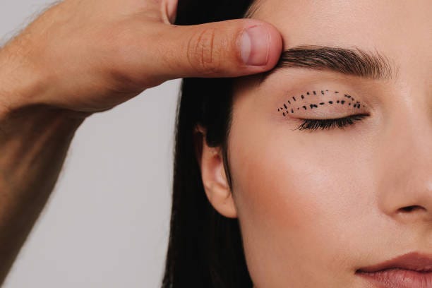 Is Eyelid Surgery Right for Droopy Lids?