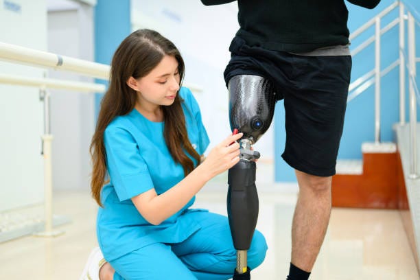 Empowering Lives: How Artificial Legs Enhance Mobility & Confidence