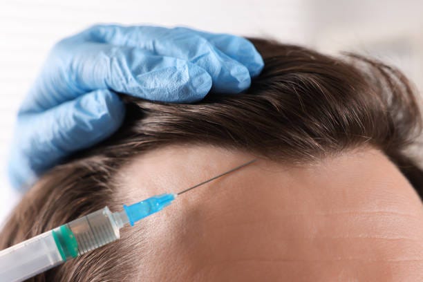Unlock Youthful Skin with Concentrated Growth Factor in Riyadh