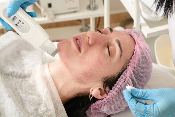 Top Laser Acne Scar Treatments in Abu Dhabi