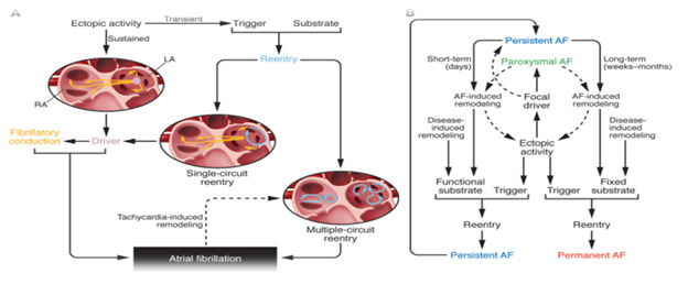 Pathophysiology and Management of Atrial Fibrillation
