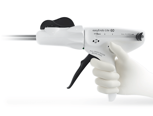 The principles and advantages of surgical staplers | by Ezisurg | Jan ...