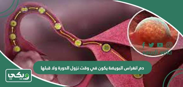 دم انغراس البويضة يكون في وقت نزول الدورة ولا قبلها | by ويكي السعودية |  Jul, 2023 | Medium