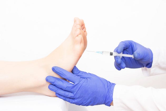 Is Botox for Foot Sweating a Permanent Fix?