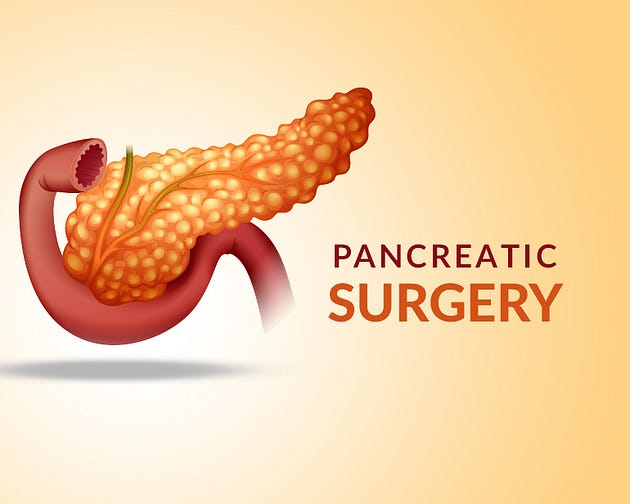Pancreatic Surgery