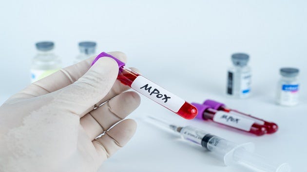 California Mpox Cases: A Closer Look at the Situation