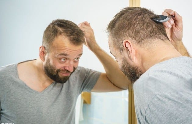 COISAS DE HOMEM: 8 DICAS PARA PREVENIR A CALVÍCIE