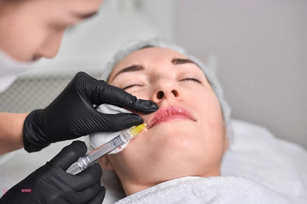 Gentle lip flip injection procedure with fine needle above upper lip for minimal discomfort.