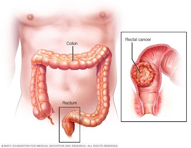 Image source: mayoclinic.org