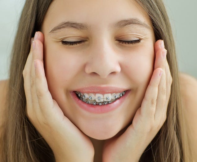 The Ultimate Guide to Teeth Braces in Dubai Everything You Need to