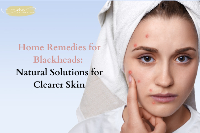 Home Remedies for Blackheads: Natural Solutions for Clearer Skin