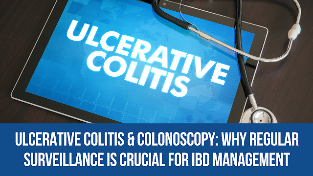 Ulcerative Colitis & Colonoscopy: Why Regular Surveillance is Crucial for IBD Management
