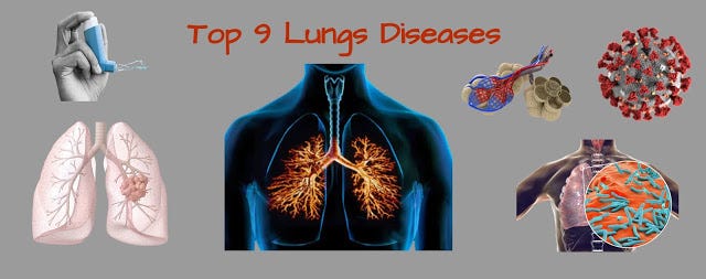 Top 9 Respiratory Disease- Causes, Signs and Symptoms | by Romit ...