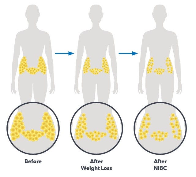 How Weight Loss Works In The Body Unveil The Science By Benjamin calories-how-weight-loss-works-houston-weight-loss-center