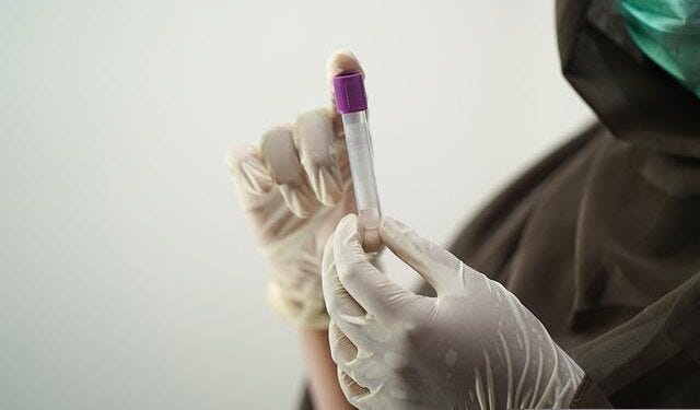 How Does Ketosis Affect Blood Tests What You Need To Know By how-does-ketosis-affect-blood-tests-what-you-need-to-know-by