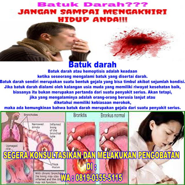 3 Jenis Obat Batuk Berdahak Tablet Di Apotik Umum | By Jepri Purnanto ...