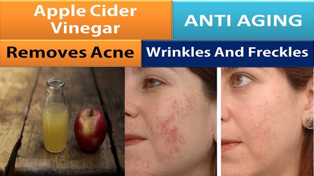 Apple Cider Vinegar Before And After Acne