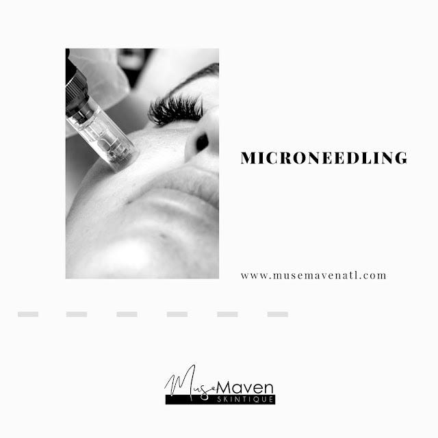 How Often Do You Need Microneedling Muse Maven Skintique Medium