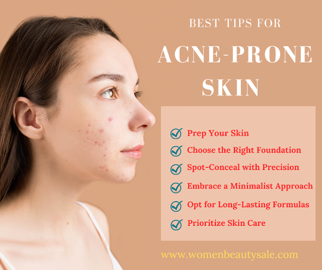 Best Tips for Acne Prone Skin: Clear & Confident!