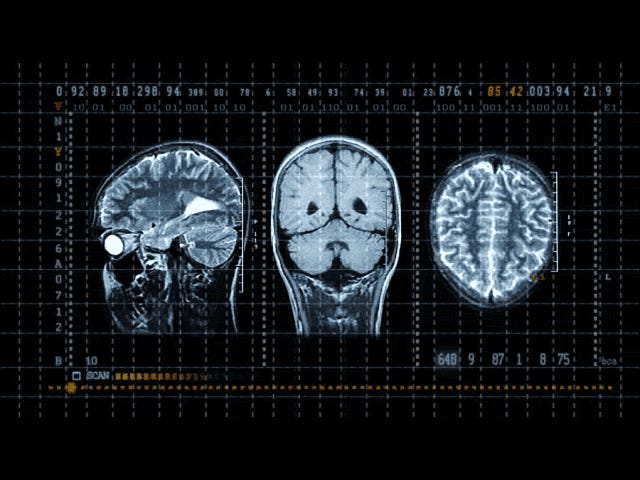The Strangest Brain Phenomena