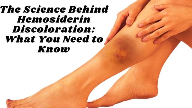 The Science Behind Hemosiderin Discoloration What You Need To Know