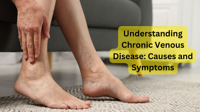 Understanding Chronic Venous Disease: Causes and Symptoms, by Jennifer  Nova