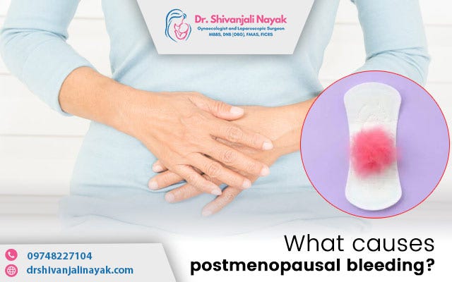 What causes postmenopausal bleeding? | Medium