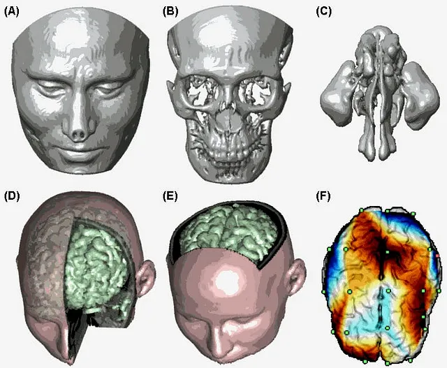 用于3D MRI和CT扫描的深度学习模型有哪些？ 四海 第1张