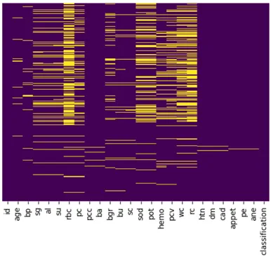 Rappresentazione visiva dei dati mancanti (indicati dalle linee gialle)