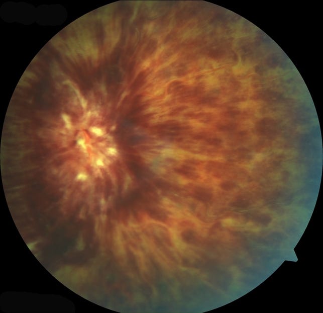 Medical Term Or Norwegian Death Metal Band Name? by Ab The Riff