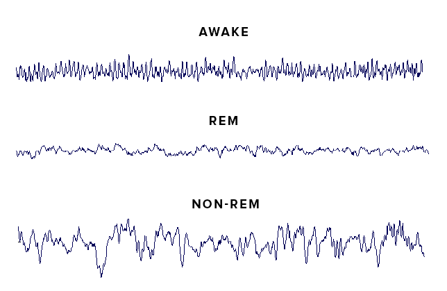 Rem фаза сна. Rem фаза сна. Rem быстрый сон. Non rem фазы сна что это. Rem стадия сна.