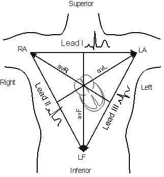 Maxim Announces Wearable ECG and Heart Monitor Development Kits - CNX  Software