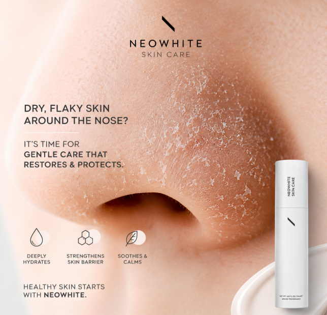 Dry, Flaky Skin Around The Nose