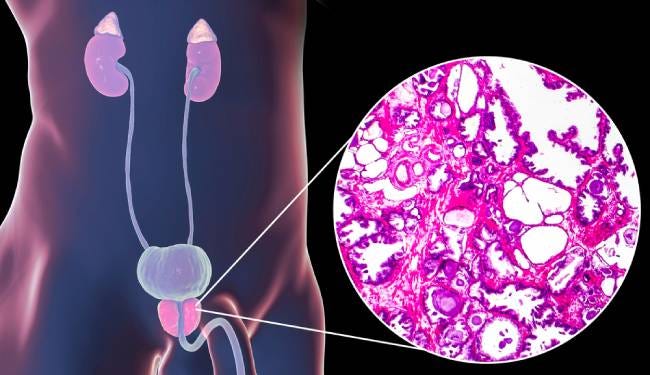 Cómo aumentar la vitalidad con testosterona: 5 métodos naturales, avalados por la ciencia