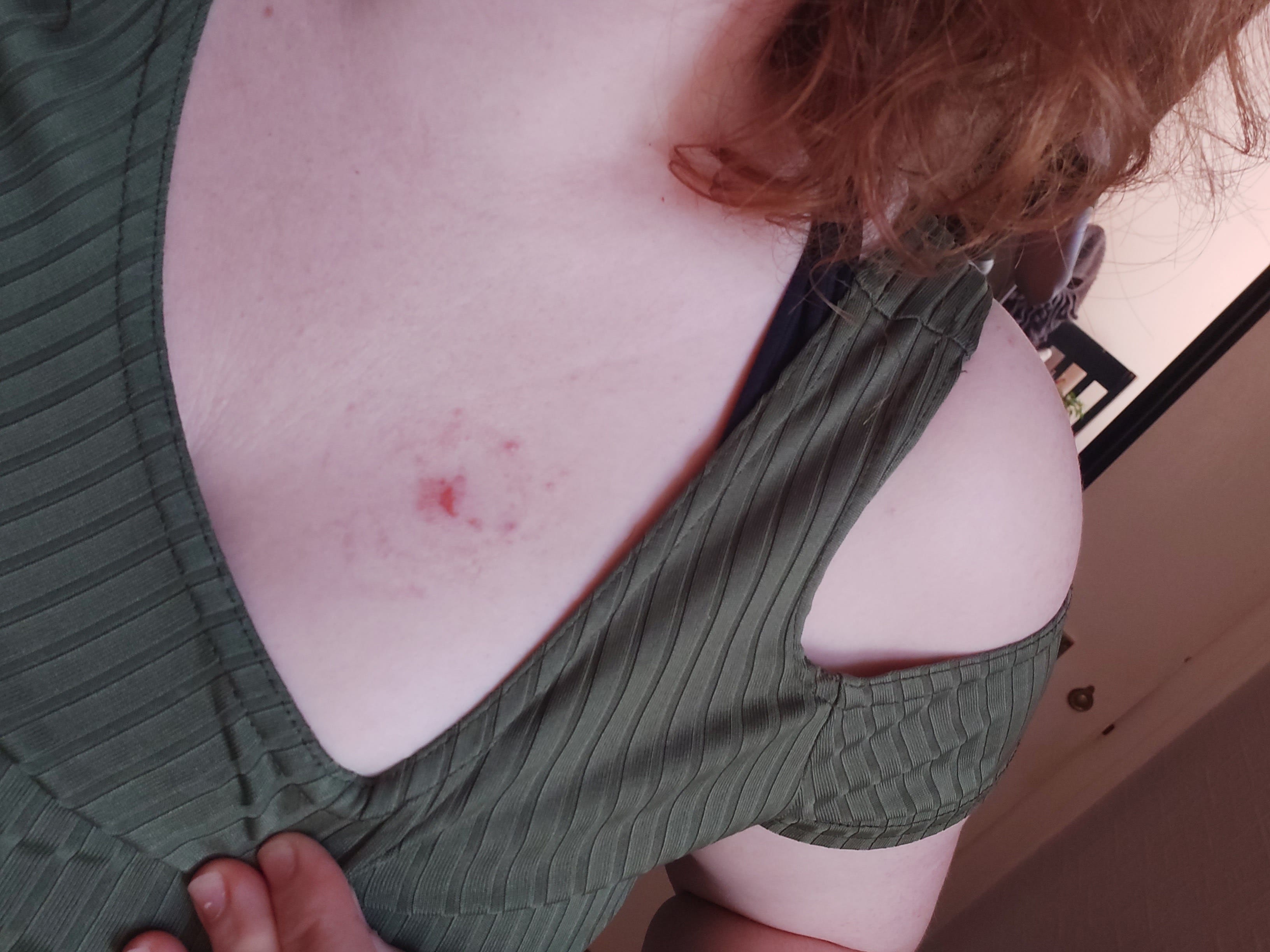 My 7 Day Heart Monitoring Test Destroyed My Skin | Medium