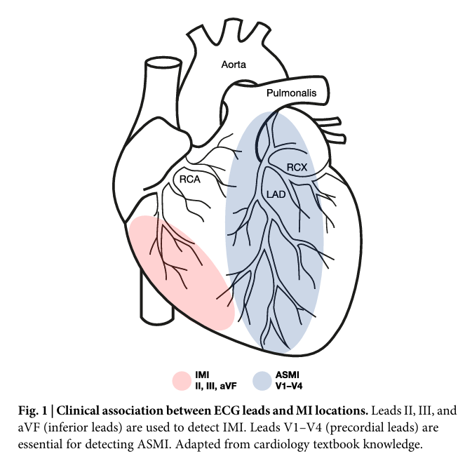 Graph Neural Networks and Explainable AI in Electrocardiography (ECG)