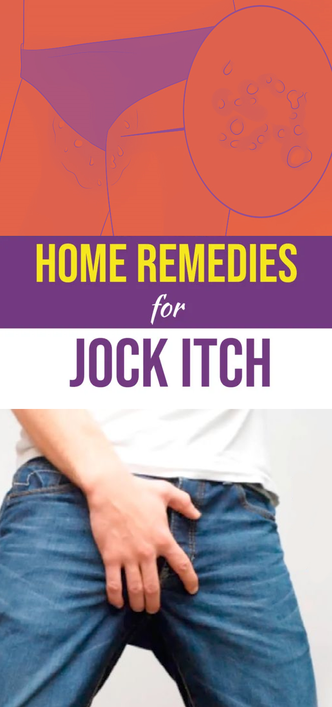 Jock Itch Home Remedy