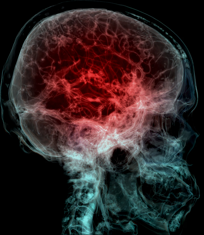 Scientists Cut Open a Human Brain in 2025.