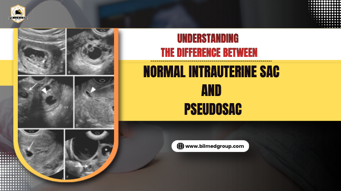 Understanding the Difference Between Normal Intrauterine Sac and Pseudosac