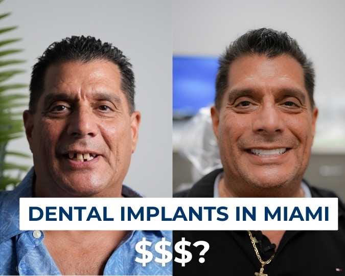 Understanding the Cost of Dental Implants in Miami | by Nuvia Dental Implant Center | May, 2024
